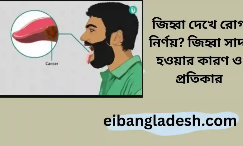 জিহ্বা দেখে রোগ নির্ণয় জিহ্বা সাদা হওয়ার কারণ ও প্রতিকার