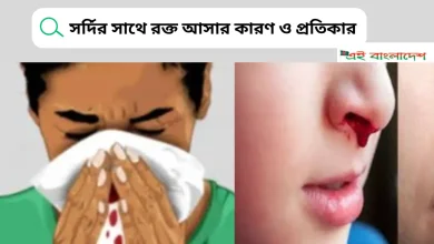 সর্দির সাথে রক্ত আসার কারণ ও প্রতিকার