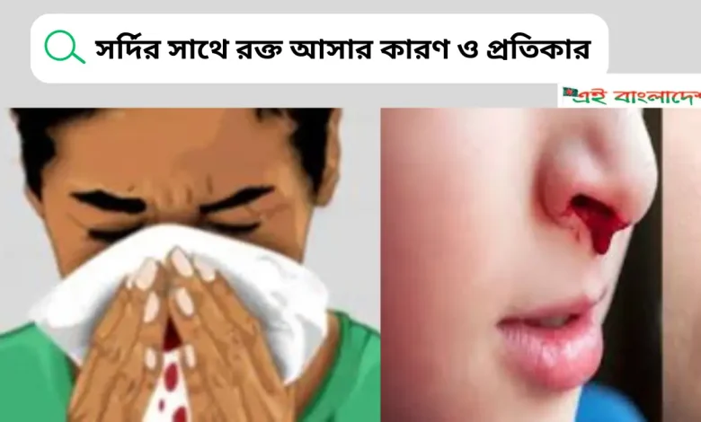 সর্দির সাথে রক্ত আসার কারণ ও প্রতিকার