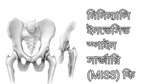 মিনিম্যালিসার্জারি